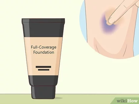 How to Cover a Bruise Effectively?